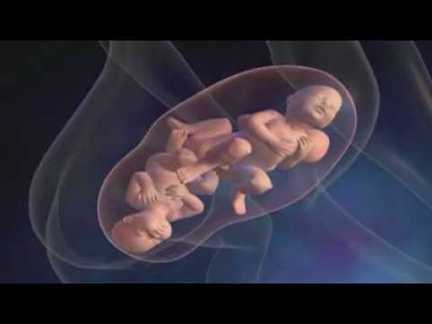 Fécondation In Vitro ou