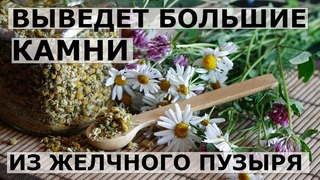 Выведет большие камни из желчного пузыря травяной рецепт.